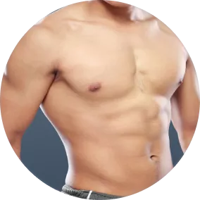 Consult gynecomastia