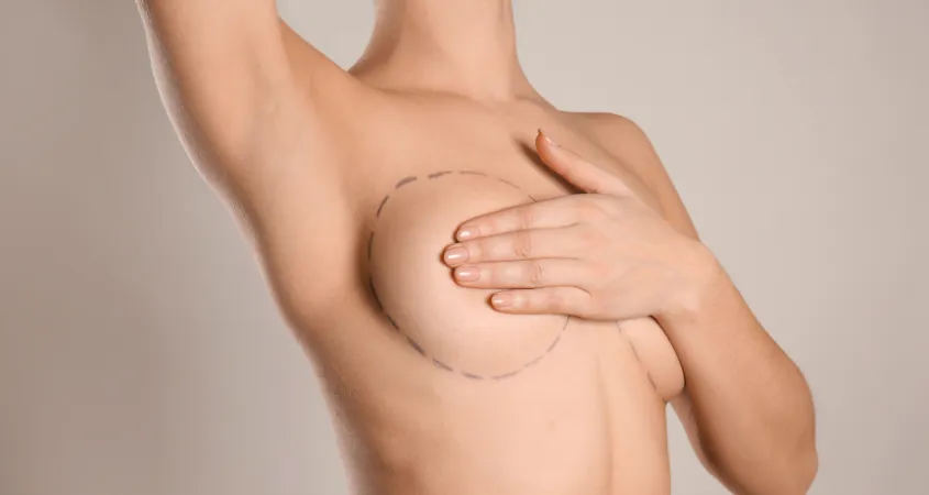 breast augm