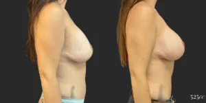 On Top® Pocket Change #12, before and after photo, view 3